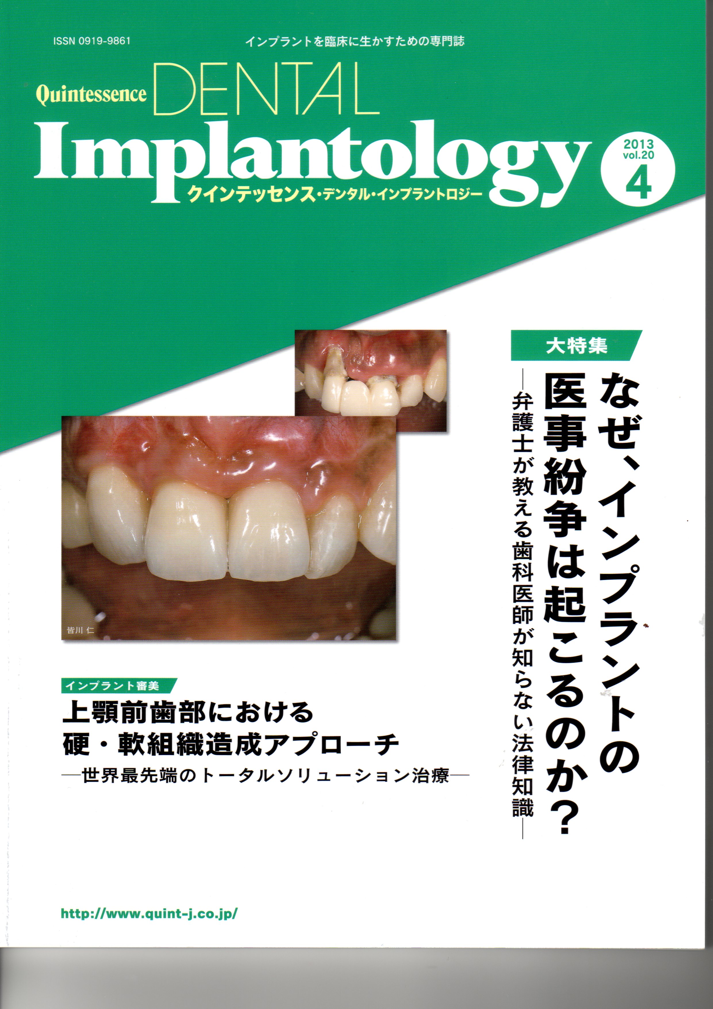 インプラントを臨床に生かすための専門誌 DENTAL Implantology - 健康 