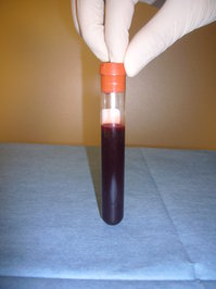 M14