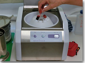 Cgf6